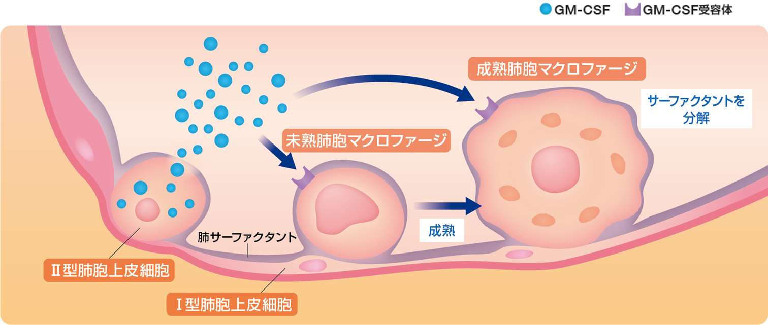 健康な人の肺胞内イメージ図。肺胞内に存在する肺サーファクタントは、Ⅱ型肺胞上皮細胞で産生され、肺胞の表面張力を低下させて肺胞が膨らみやすくなる役割を担っています。健常人では、未分化な肺胞マクロファージはⅡ型肺胞上皮細胞が産生するGM-CSFにより成熟肺胞マクロファージに分化し、サーファクタントを分解します。