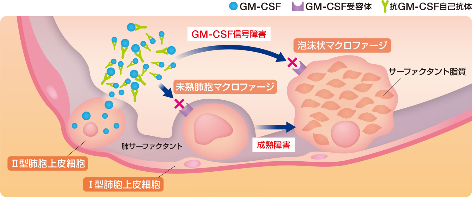 自己免疫性肺胞蛋白症の原因は、GM-CSFを阻害する抗GM-CSF自己抗体が生じ、肺胞マクロファージが機能しなくなることです