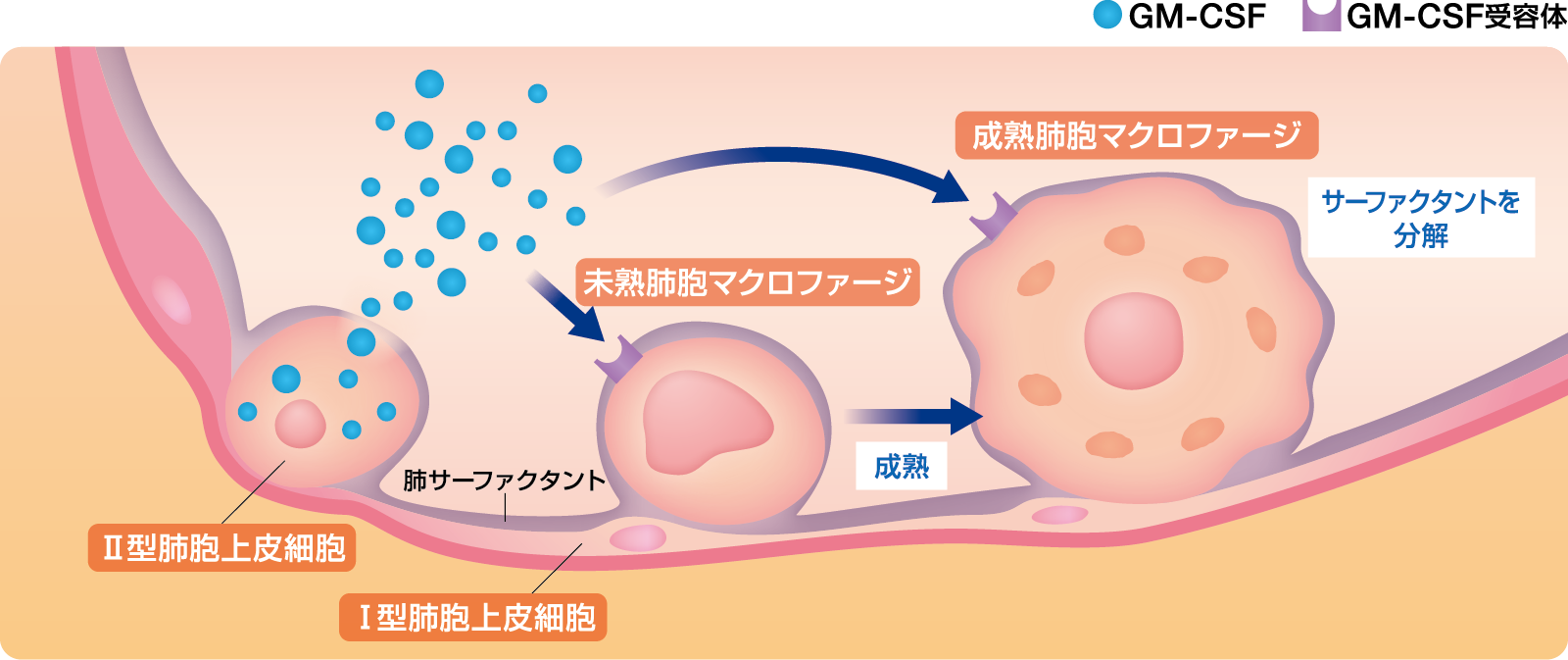 健康な人の肺胞内イメージ図。肺胞内に存在する肺サーファクタントは、Ⅱ型肺胞上皮細胞で産生され、肺胞の表面張力を低下させて肺胞が膨らみやすくなる役割を担っています。健常人では、未分化な肺胞マクロファージはⅡ型肺胞上皮細胞が産生するGM-CSFにより成熟肺胞マクロファージに分化し、サーファクタントを分解します。